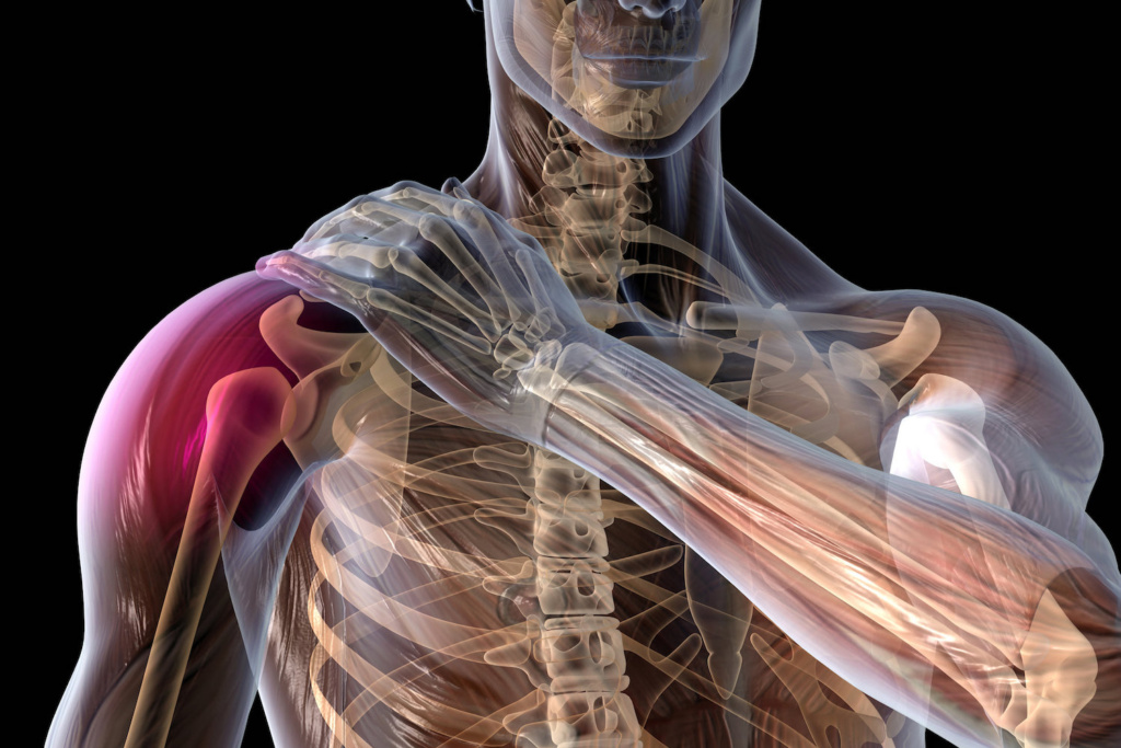 3D illustration showing painful shoulder joint of a man, rheumatoid arthritis